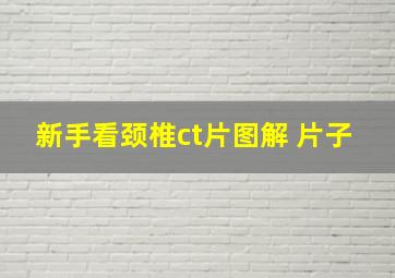 新手看颈椎ct片图解 片子